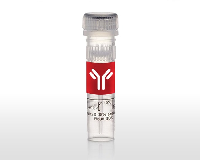 Ki-67 Monoclonal Antibody (SolA15), eBioscience™