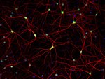 Donkey anti-Rabbit IgG (H+L) Highly Cross-Adsorbed Secondary Antibody, Alexa Fluor™ 594 Donkey anti-Rabbit IgG (H+L) Highly Cross-Adsorbed Secondary Antibody, Alexa Fluor™ 594
