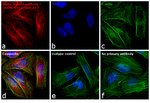 Donkey anti-Mouse IgG (H+L) Highly Cross-Adsorbed Secondary Antibody, Alexa Fluor™ 647 Donkey anti-Mouse IgG (H+L) Highly Cross-Adsorbed Secondary Antibody, Alexa Fluor™ 647