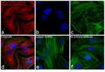 Donkey anti-Rabbit IgG (H+L) Highly Cross-Adsorbed Secondary Antibody, Alexa Fluor™ 555 Donkey anti-Rabbit IgG (H+L) Highly Cross-Adsorbed Secondary Antibody, Alexa Fluor™ 555