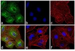 Donkey anti-Rat IgG (H+L) Highly Cross-Adsorbed Secondary Antibody, Alexa Fluor™ 488 Donkey anti-Rat IgG (H+L) Highly Cross-Adsorbed Secondary Antibody, Alexa Fluor™ 488