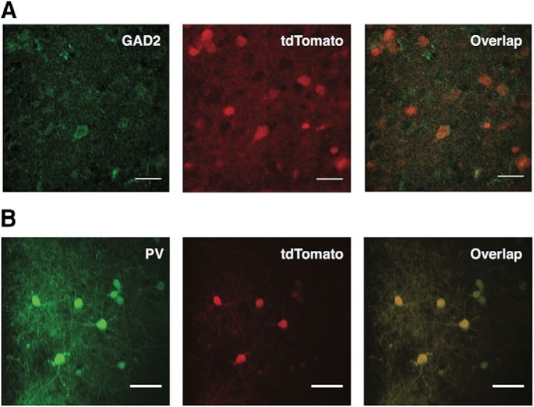GAD65 Antibody (PA522260)