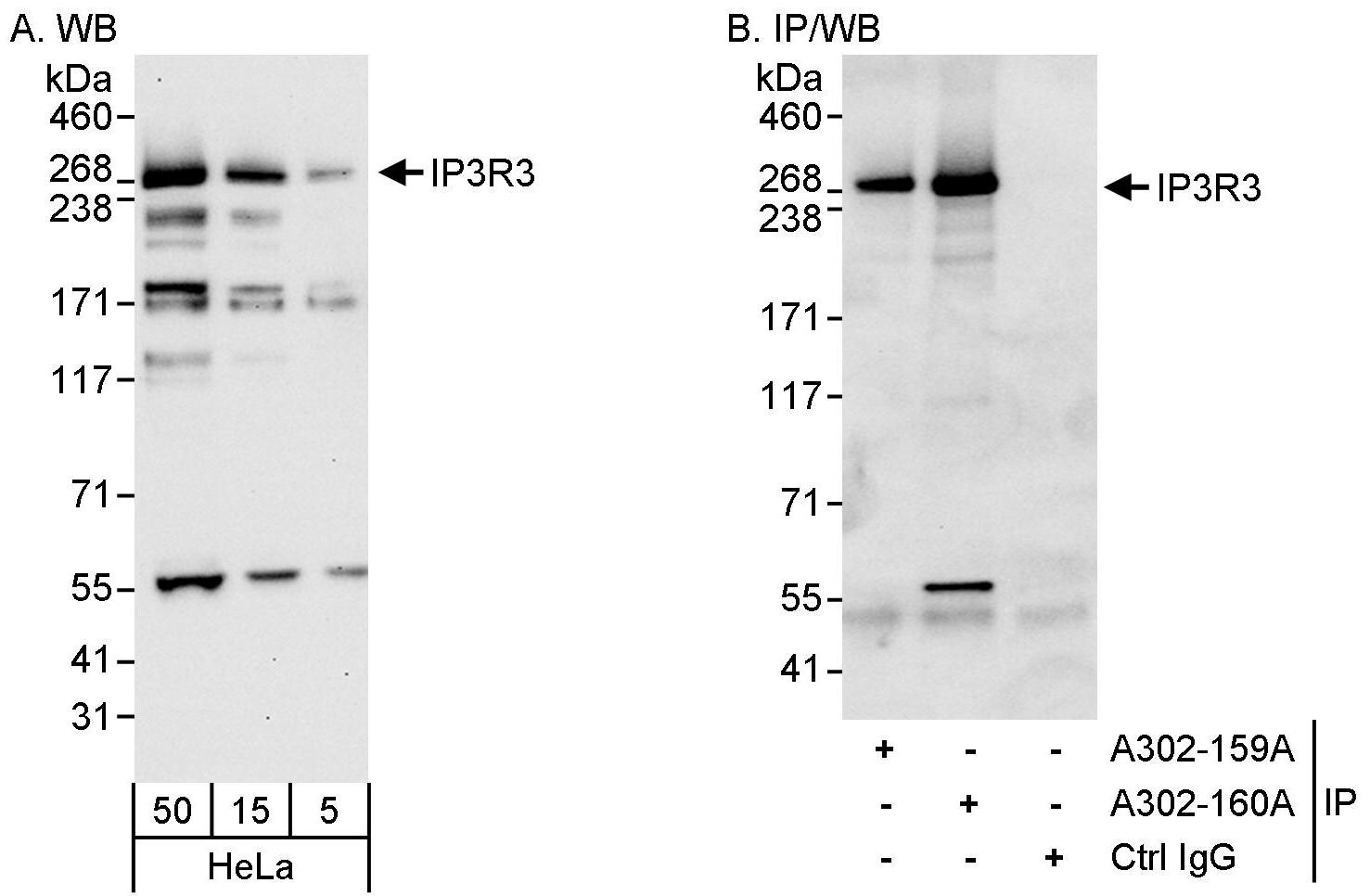 IP3R3 Antibody (A302-160A)