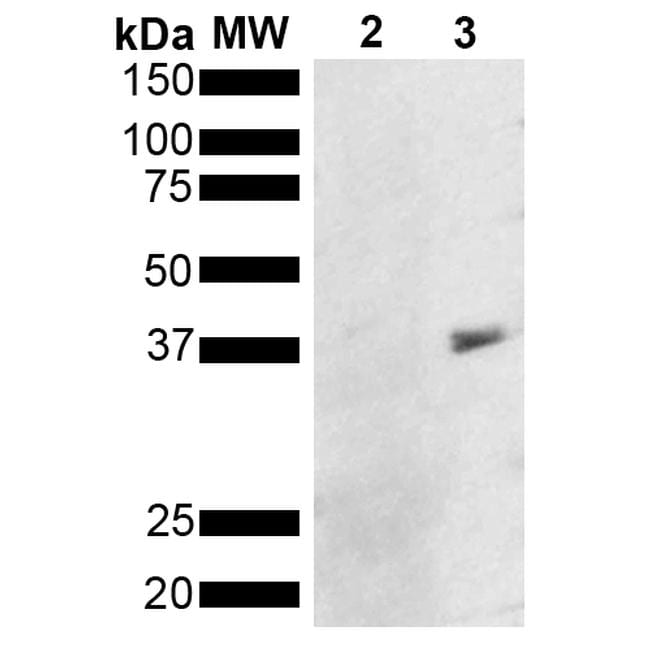 Metallothionein Antibody (MA527587)