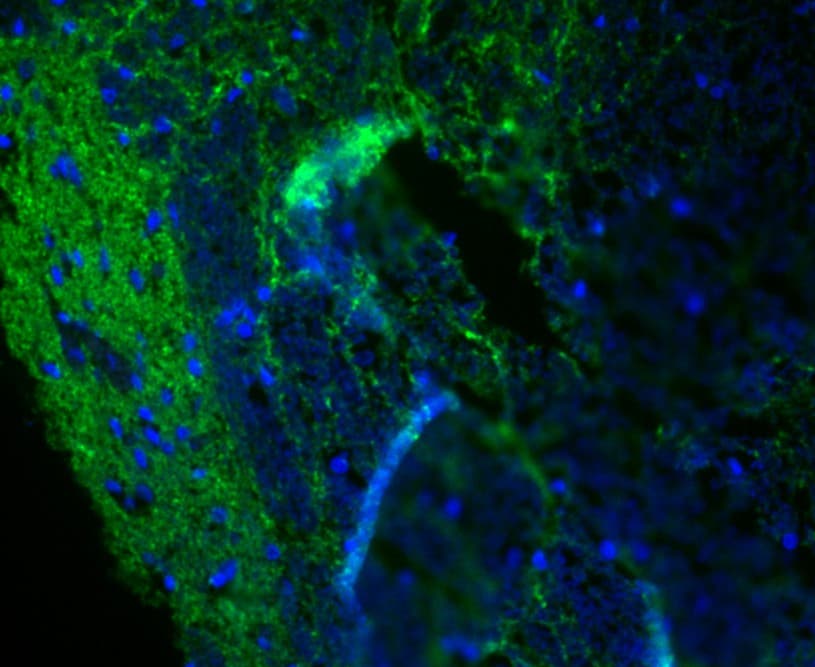 Synapsin II Antibody (MA5-36141)