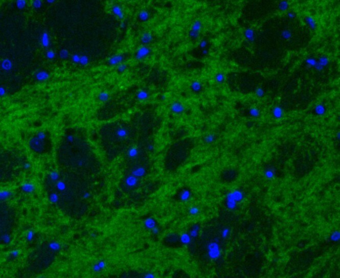 Synapsin II Antibody (MA5-36141)