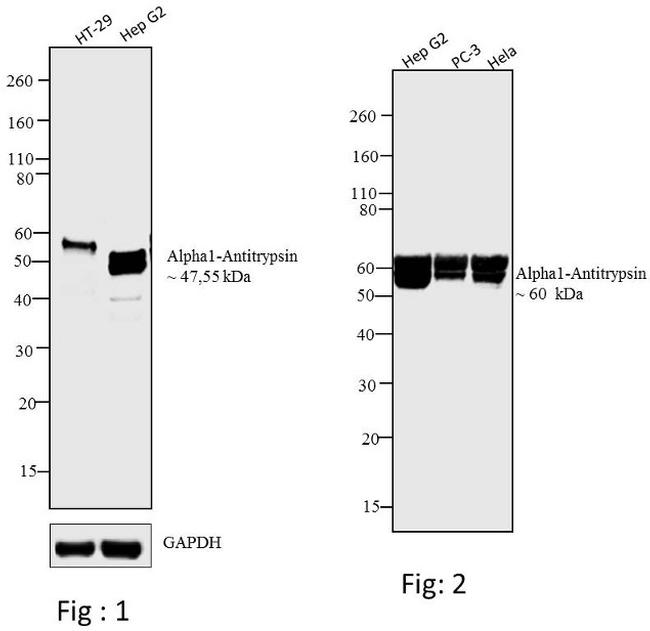 alpha1 Antitrypsin Antibody (MA514661)