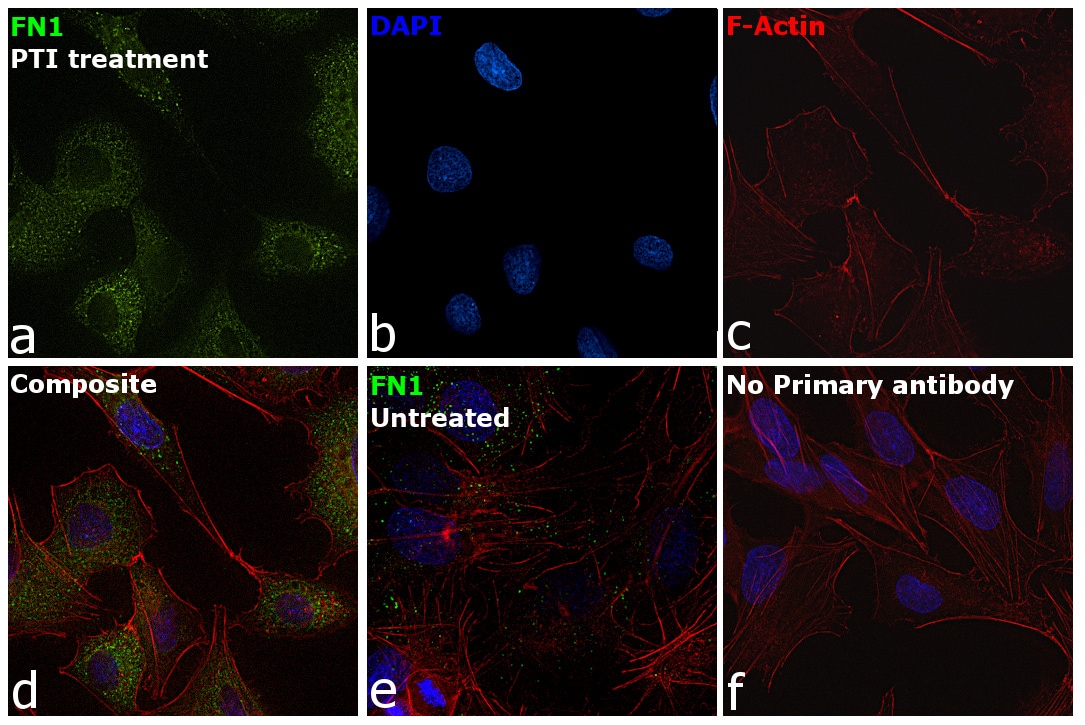 Fibronectin Antibody (MA514737)