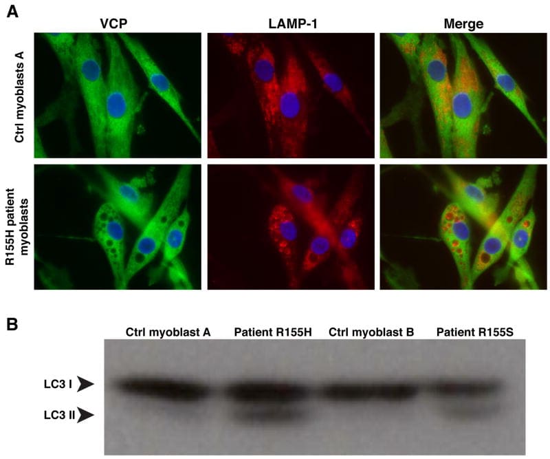 LAMP1 Antibody (PA1654A)