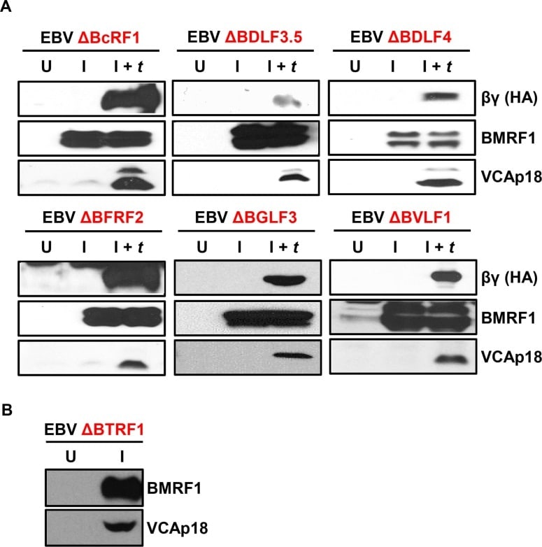 Epstein Barr Virus p18 Antibody (PA173003)
