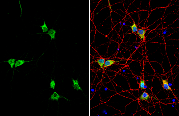 Synapsin II Antibody (PA5-117446)