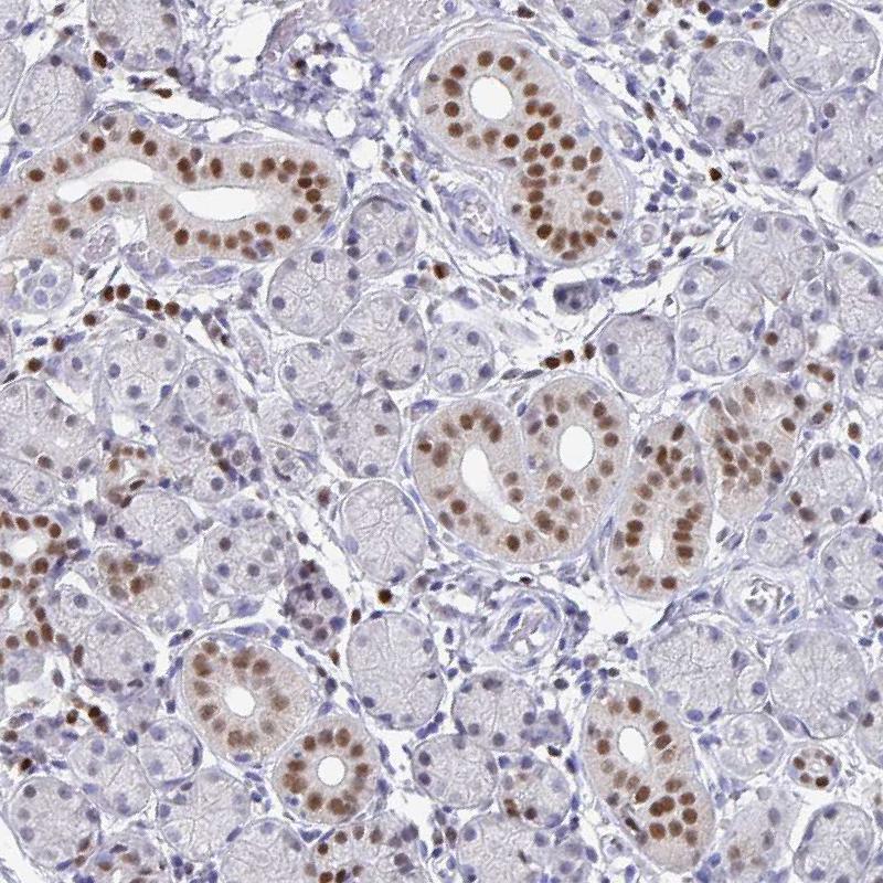 RUNX2 Antibody (PA5-82787)