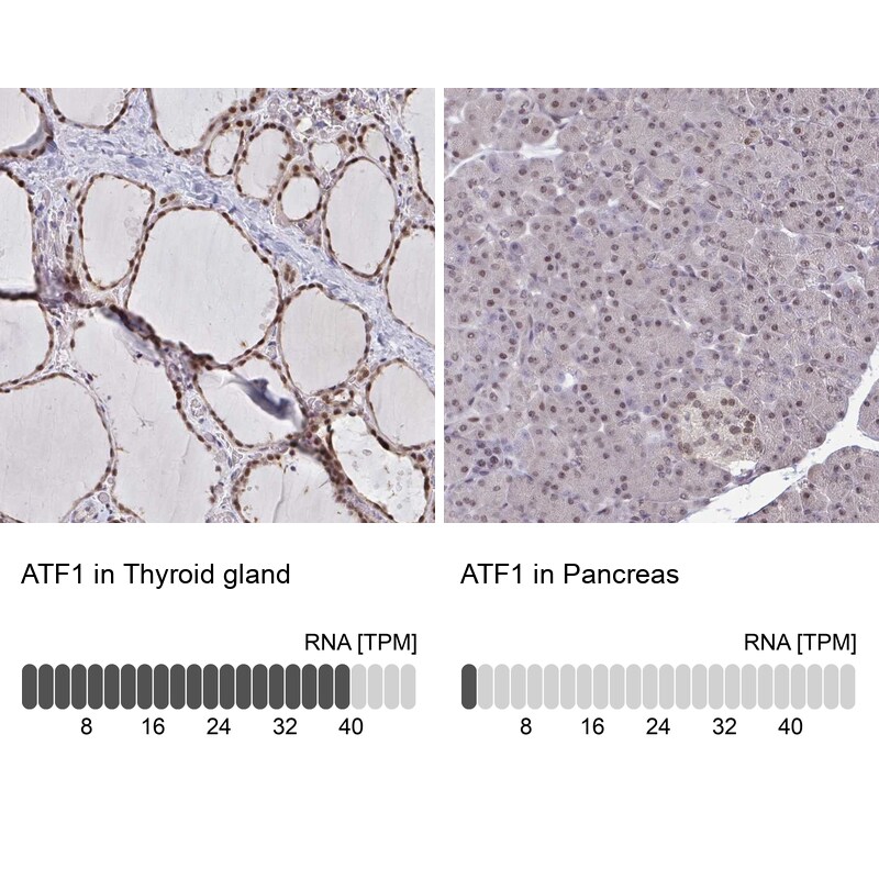 ATF1 Antibody (PA5-84236)