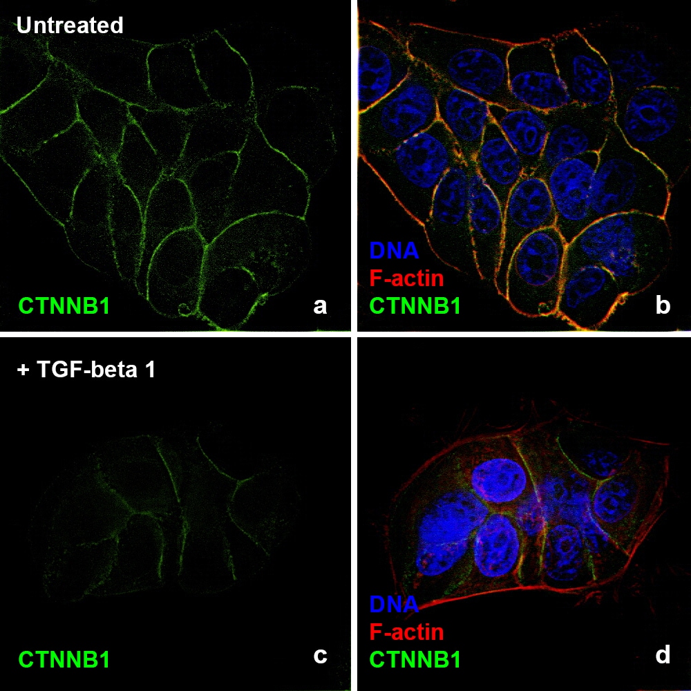 Human TGFbeta 1 Protein (PHG9214)